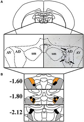 Post-training Inactivation of the Anterior Thalamic Nuclei Impairs <mark class="highlighted">Spatial Performance</mark> on the Radial Arm Maze